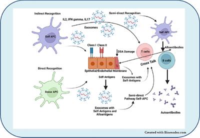 Extracellular Vesicles Mediate Immune Responses to Tissue-Associated Self-Antigens: Role in Solid Organ Transplantations